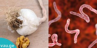 ეს პროდუქტები ორგანიზმს პარაზიტებისგან იცავენ. ინფორმაცია, რომელიც ყველამ უნდა იცოდეს