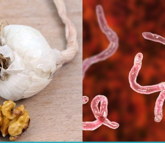 ეს პროდუქტები ორგანიზმს პარაზიტებისგან იცავენ. ინფორმაცია, რომელიც ყველამ უნდა იცოდეს