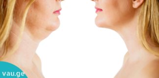 ნატურალური საშუალებები ღაბაბის საწინააღმდეგოდ! ამიერიდან ეს პრობლემა აღარ შეგაწუხებთ!