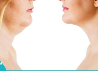 ნატურალური საშუალებები ღაბაბის საწინააღმდეგოდ! ამიერიდან ეს პრობლემა აღარ შეგაწუხებთ!