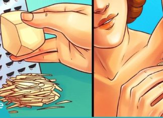 იღლიის სიშავე გაწუხებთ? ამ პრობლემას უმი კარტოფილი სამუდამოდ დაგავიწყებთ