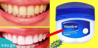 კბილების გათეთრება ვაზელინის დახმარებით. ეს მეთოდი ყველას მოეწონება