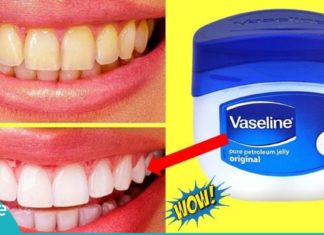 კბილების გათეთრება ვაზელინის დახმარებით. ეს მეთოდი ყველას მოეწონება