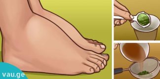 სითხის შეკავებით გამოწვეული შეშუპება, გაიგეთ ამ პრობლემის მოგვარების 5 მეთოდი…