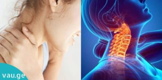 ეს რეცეპტი კისრის ტკივილს სამუდამოდ დაგავიწყებთ! მარტივად მოსამზადებელი ეფექტური წამალი