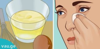 ეფექტური საშუალება ნაოჭების წინააღმდეგ– საიდუმლო მხოლოდ 2 ინგრედიენტშია!