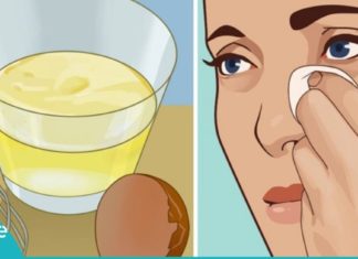 ეფექტური საშუალება ნაოჭების წინააღმდეგ– საიდუმლო მხოლოდ 2 ინგრედიენტშია!