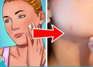 ნიღაბი იმისთვის, რომ ერთხელ და სამუდამოდ დაივიწყოთ ტერმინი – ”პრობლემური კანი”