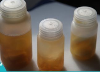 ეს ნარევი ებრძვის მაღალ წნევას, ათეროსკლეროზს და რევმატიზმს. ნამდვილად სასწაულმოქმედი საშუალებაა