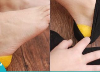 აი, რატომ ჩაიდო მან ლიმონის ქერქი წინდაში. ეს მეთოდი გაგაოცებთ