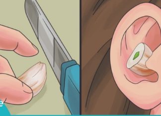 ჩაიდეთ ნიორის კბილი ყურში და ნახეთ რა მოხდება. ამ მეთოდმა ავადმყოფობას გადამარჩინა