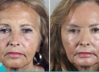 სახამებლის დაუჯერებელი ეფექტი სახის კანზე. ის, რაც ყველა მანდილოსანმა უნდა იცოდეს