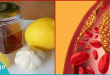 ნარევი, რომელიც სისხლში ქოლესტერინის და ტრიგლიცერიდების დონეს ამცირებს