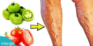 აი ასე უნდა უმკურნალოთ ვარიკოზულ ვენებს პომიდვრის დახმარებით. აუცილებლად სცადეთ