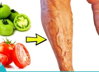 აი ასე უნდა უმკურნალოთ ვარიკოზულ ვენებს პომიდვრის დახმარებით. აუცილებლად სცადეთ