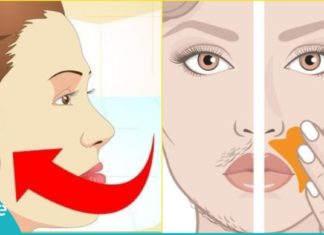 მოიშორეთ სახიდან არასასურველი თმა სახლის პირობებში. იაფი და ეფექტური მეთოდები