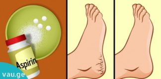 აი ასე უნდა მოუაროთ თქვენს ფეხებს. ასპირინის დაუჯერებელი შედეგები