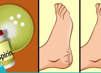 აი ასე უნდა მოუაროთ თქვენს ფეხებს. ასპირინის დაუჯერებელი შედეგები