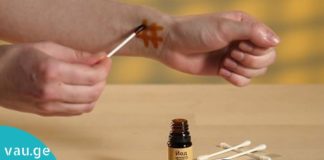 წაისვით იოდი მაჯებზე და ნახეთ რა მოხდება- საინტერესო ინფორმაციაა.