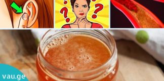 ეს სასწაულმოქმედი ნარევი აუმჯობესებს სმენას და მეხსიერებას და ებრძვის ათეროსკლეროზს