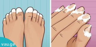 აი, რა ეფექტი ექნება სოდას თუ ფრჩხილებზე წაისვამთ. ამის შემდეგ ასე ხშირად მოიქცევით