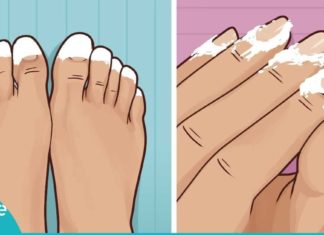 აი, რა ეფექტი ექნება სოდას თუ ფრჩხილებზე წაისვამთ. ამის შემდეგ ასე ხშირად მოიქცევით