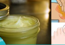 დაამზადეთ კვერცხის მალამო სახლში და განიკურნეთ სახსრების ტკივილისგან, ფრჩხილის სოკოსგან და კიდევ სხვა დაავადებებისგან