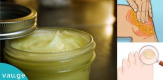 დაამზადეთ კვერცხის მალამო სახლში და განიკურნეთ სახსრების ტკივილისგან, ფრჩხილის სოკოსგან და კიდევ სხვა დაავადებებისგან