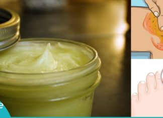 დაამზადეთ კვერცხის მალამო სახლში და განიკურნეთ სახსრების ტკივილისგან, ფრჩხილის სოკოსგან და კიდევ სხვა დაავადებებისგან