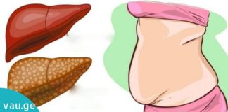 ეს 7 ნატურალური პროდუქტი თქვენს ღვიძლს იდეალურად გაწმენდს. ის, რაც ყველას სჭირდება