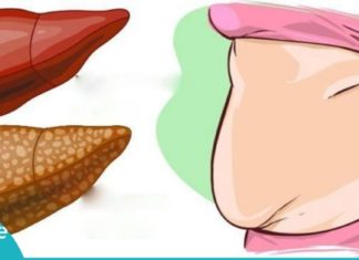 ეს 7 ნატურალური პროდუქტი თქვენს ღვიძლს იდეალურად გაწმენდს. ის, რაც ყველას სჭირდება