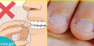 აი, რატომ არ შეიძლება ფრჩხილების კვნეტა. ამის შემდეგ ფრჩხილს ტუჩთან შიშით ვეღარ მიიტანთ