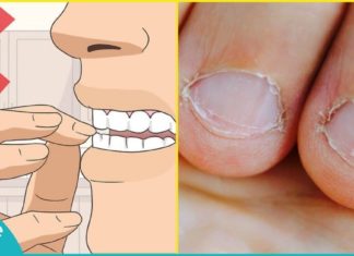 აი, რატომ არ შეიძლება ფრჩხილების კვნეტა. ამის შემდეგ ფრჩხილს ტუჩთან შიშით ვეღარ მიიტანთ