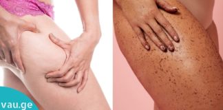 ანტიცელულიტური ნიღაბი ყავით – 10 პროცედურის შემდეგ პრობლემა გაქრება