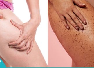 ანტიცელულიტური ნიღაბი ყავით – 10 პროცედურის შემდეგ პრობლემა გაქრება