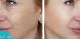 მარტივი ინგრედიენტებისგან გაკეთებული ნიღაბი სახიდან ასაკის კვალს გაგიქრობთ!