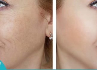 მარტივი ინგრედიენტებისგან გაკეთებული ნიღაბი სახიდან ასაკის კვალს გაგიქრობთ!