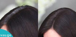 ეს ნატურალური საშუალება ჭაღარა თმას მოგაშორებთ! ქიმიური საღებავები აღარ დაგჭირდებათ!