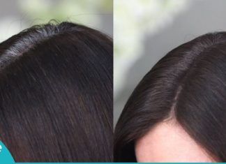 ეს ნატურალური საშუალება ჭაღარა თმას მოგაშორებთ! ქიმიური საღებავები აღარ დაგჭირდებათ!