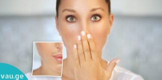 როგორ მოვიშოროთ არასასურველი თმა ტუჩებთან? რეცეპტი, რომელიც კანს არბილებს და კვებავს