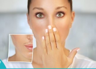 როგორ მოვიშოროთ არასასურველი თმა ტუჩებთან? რეცეპტი, რომელიც კანს არბილებს და კვებავს