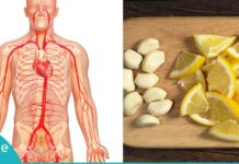 არტერიების გასუფთავება ნიორის და ლიმონის დახმარებით. ყველაზე ეფექტური საშუალება!