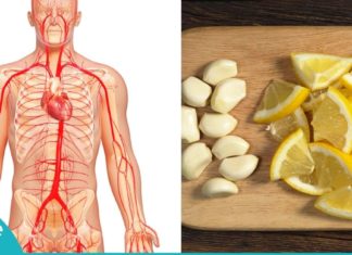 არტერიების გასუფთავება ნიორის და ლიმონის დახმარებით. ყველაზე ეფექტური საშუალება!