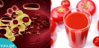 გაისუფთავეთ ორგანიზმი ქოლესტერინისგან ამ ჯადოსნური სასმელით! ბუნებრივი საშულება!