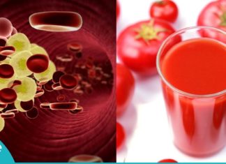 გაისუფთავეთ ორგანიზმი ქოლესტერინისგან ამ ჯადოსნური სასმელით! ბუნებრივი საშულება!