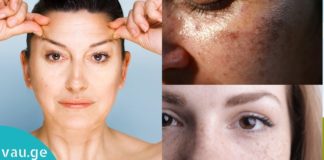 დაამზადეთ ეს ლოსიონი და მოიშორეთ ნაოჭები, ჭორფლები და პიგმენტური ლაქები. შედეგი გარანტირებულია!