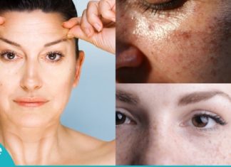 დაამზადეთ ეს ლოსიონი და მოიშორეთ ნაოჭები, ჭორფლები და პიგმენტური ლაქები. შედეგი გარანტირებულია!