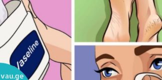 ვაზელინის გამოყენების თავის მოვლის დროს – პრაქტიკული ინფორმაცია, რომელიც უნდა იცოდეთ!