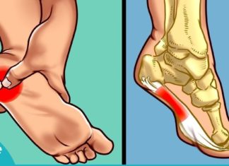 საუკეთესო საშუალება ქუსლების ტკივილის სამკურნალოდ! ეფექტურია!