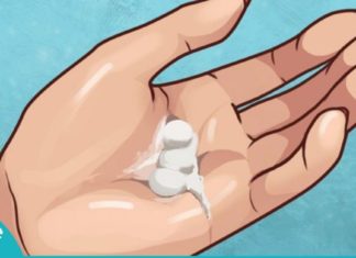 მან ასპირინი თმაში შეიზილა, აი რა მიიღო შედეგად… სასარგებლო ინფორმაცია!